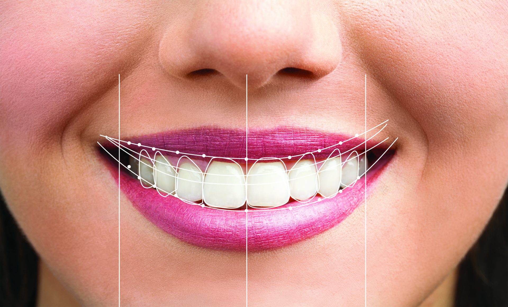 smiledesign smiledesign