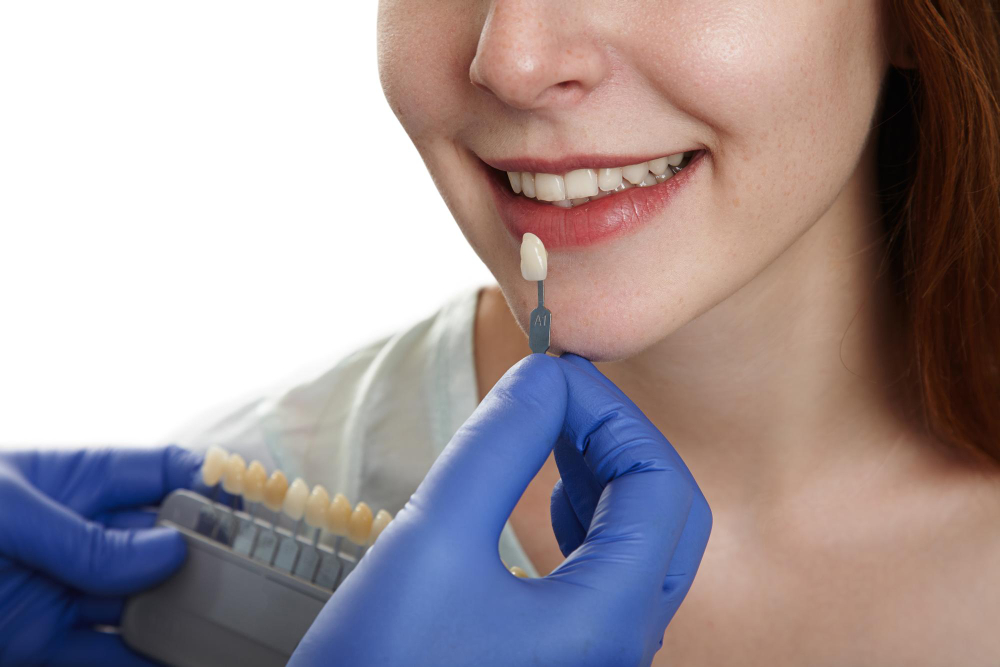 Step-by-Step Guide to Getting a Dental Crown