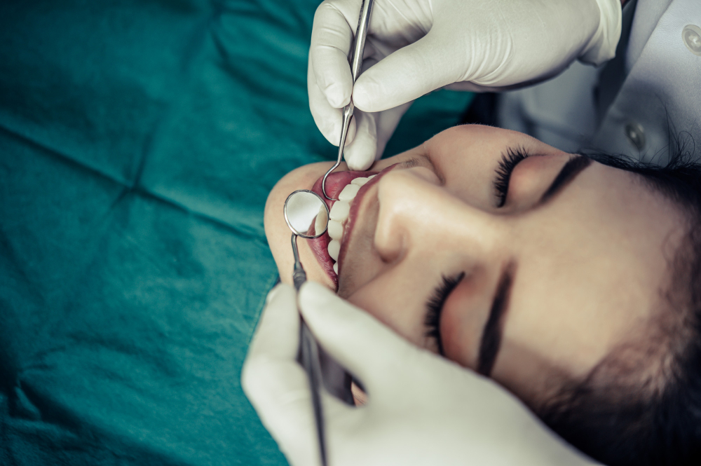 How to Care for Your Dental Fillings