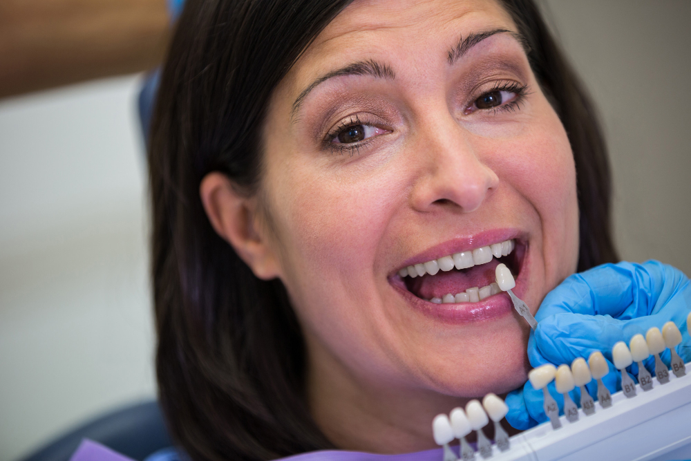 Veneers vs. Bonding: Which Is Right for Your Smile?