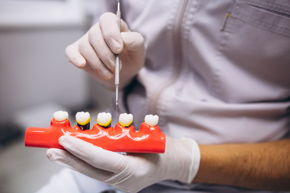 Crowns vs. Fillings: Which Is Right for You?