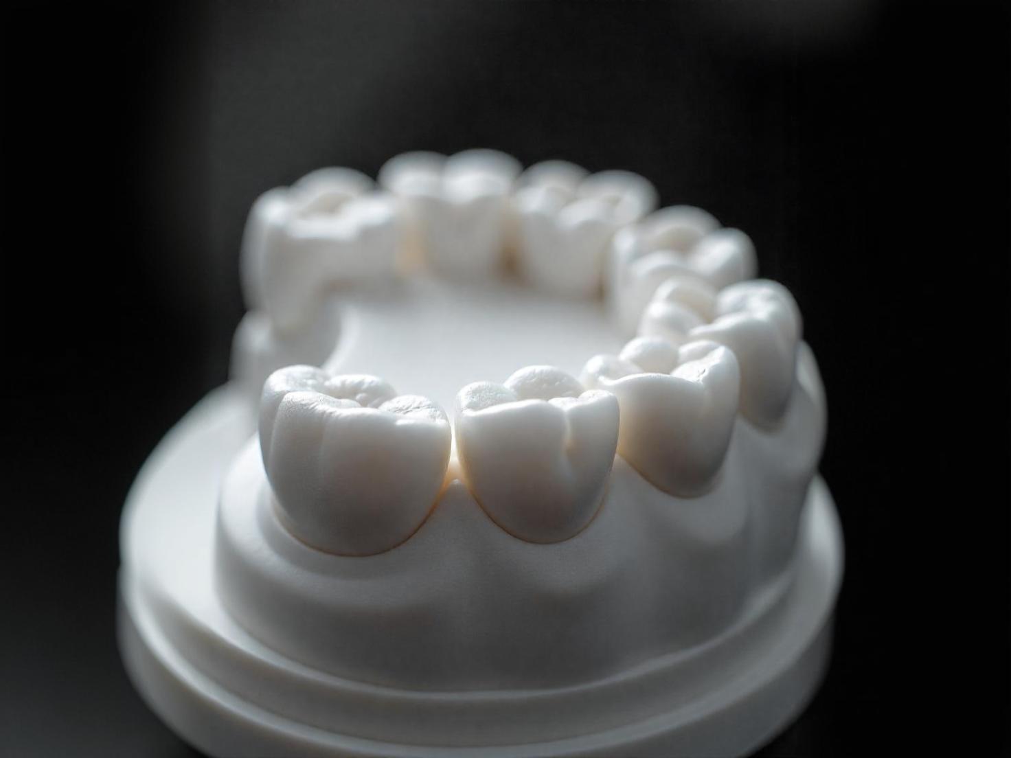 Composite vs. Porcelain Veneers | Roots Dental Care